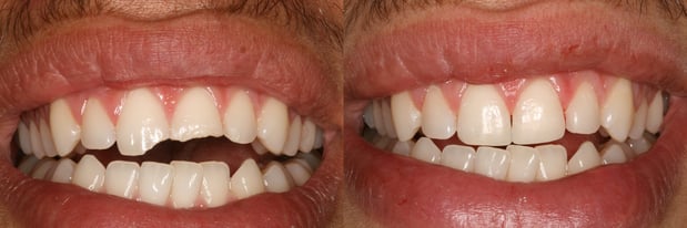 Images Campbell Dental Arts