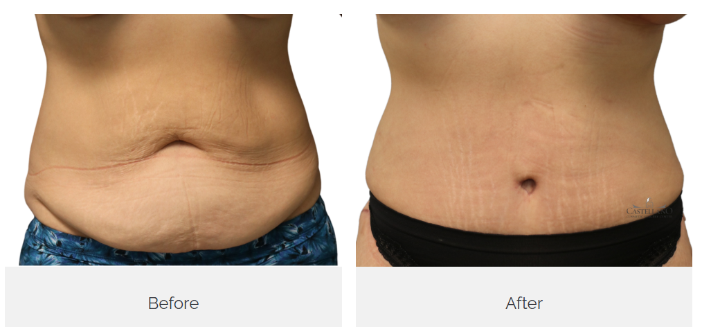 Castellano Cosmetic Surgery Center Image