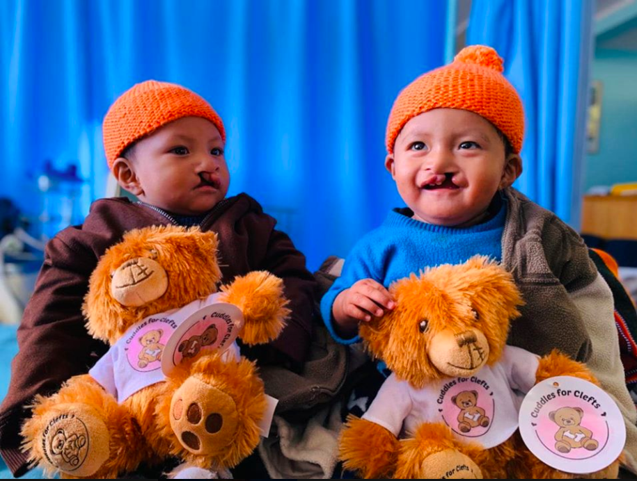 Two Twins both with Cleft Lip and Palate