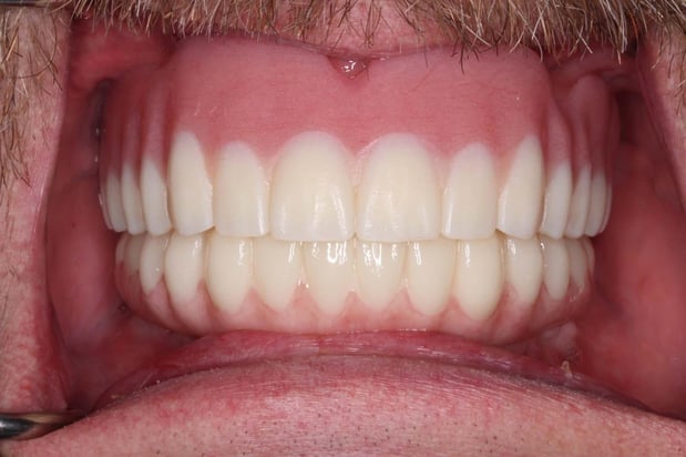 Images Paladin Dental