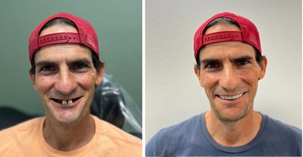 Images Redeemed Smiles - Dentures Implants & Dentistry Yukon