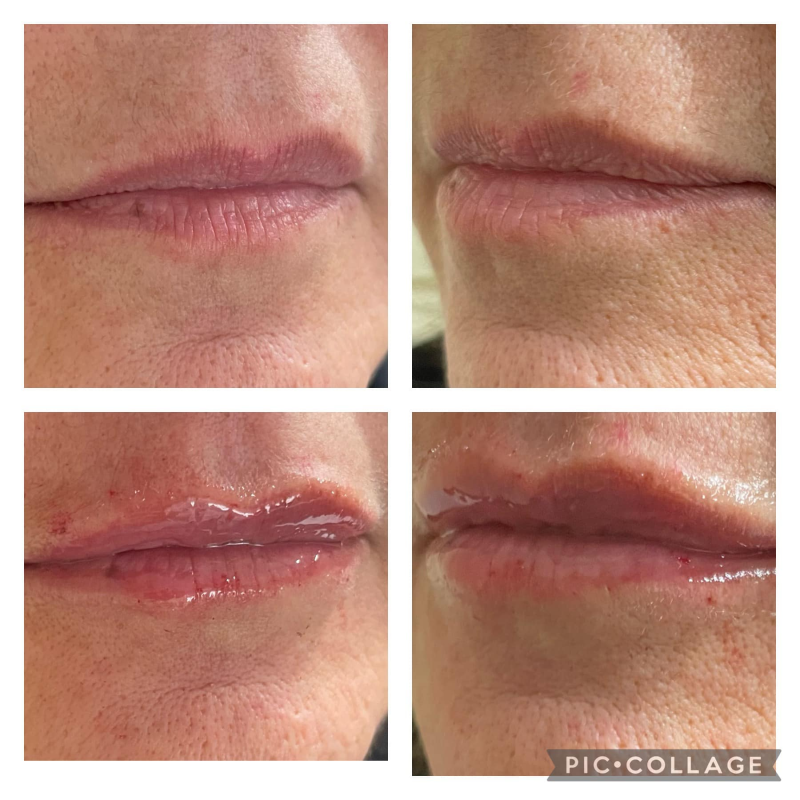 Images Astorino Dott. Luigi Medicina Estetica e Metodica Trap