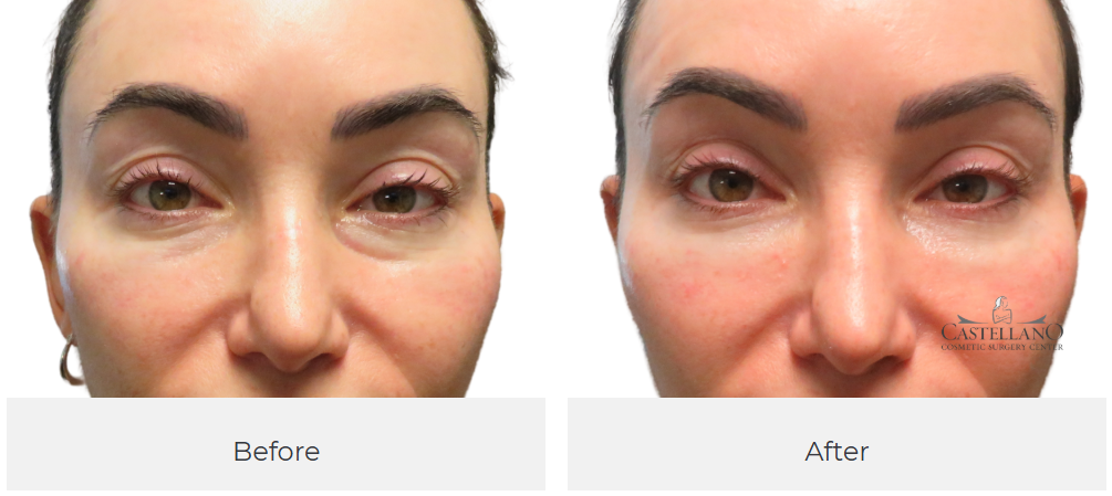 Castellano Cosmetic Surgery Center Image