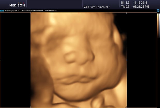 Images Heavenly 3D 4D Ultrasounds