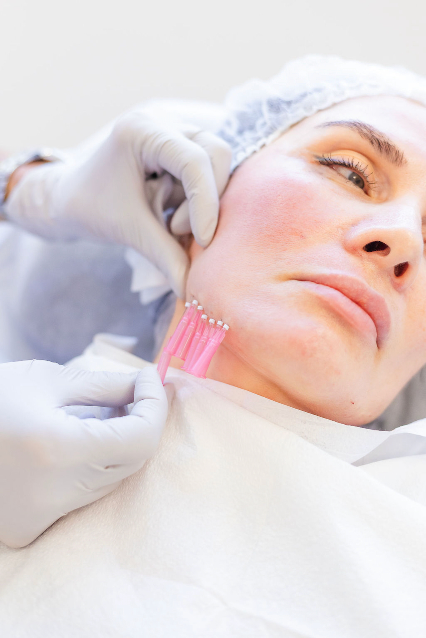 Ridgefield Aesthetics offers advanced aesthetic treatments, including dermal fillers, laser skin revitalization, and body contouring, led by Dr. Zina Boutaeva and her expert team. Prioritizing comfort, safety, and personalized care, they help clients achieve radiant skin and enhanced confidence. Visit us near downtown Ridgefield, CT.