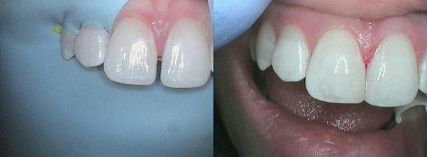 Images Verde Pointe Dental Associates
