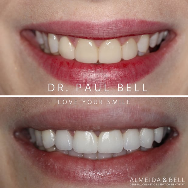 Images Almeida & Bell Dental Lone Tree - General, Cosmetic, and Implant Dentistry
