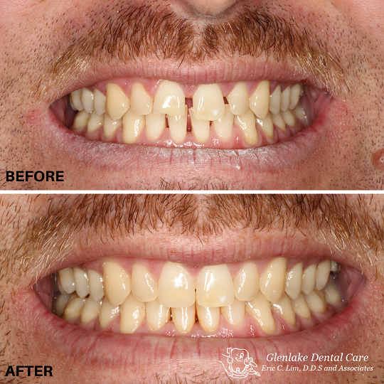 Images Glenlake Dental Care
