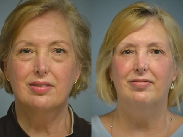 Images Providence Facial Plastic and Cosmetic Surgery