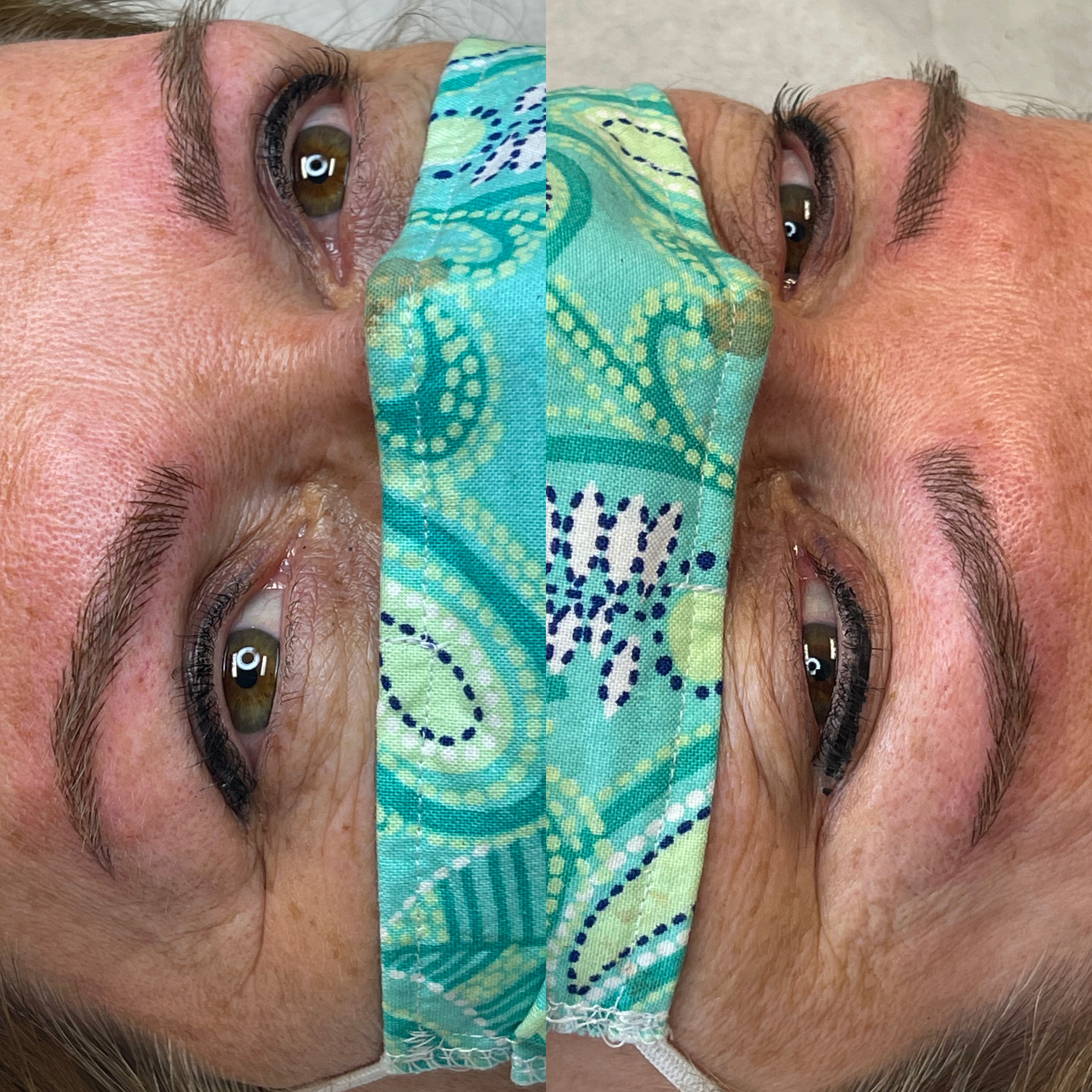 Images Clinique d'Esthétique Leila - Hydrafacial, Microblading, Épilation Laser Sainte-Foy