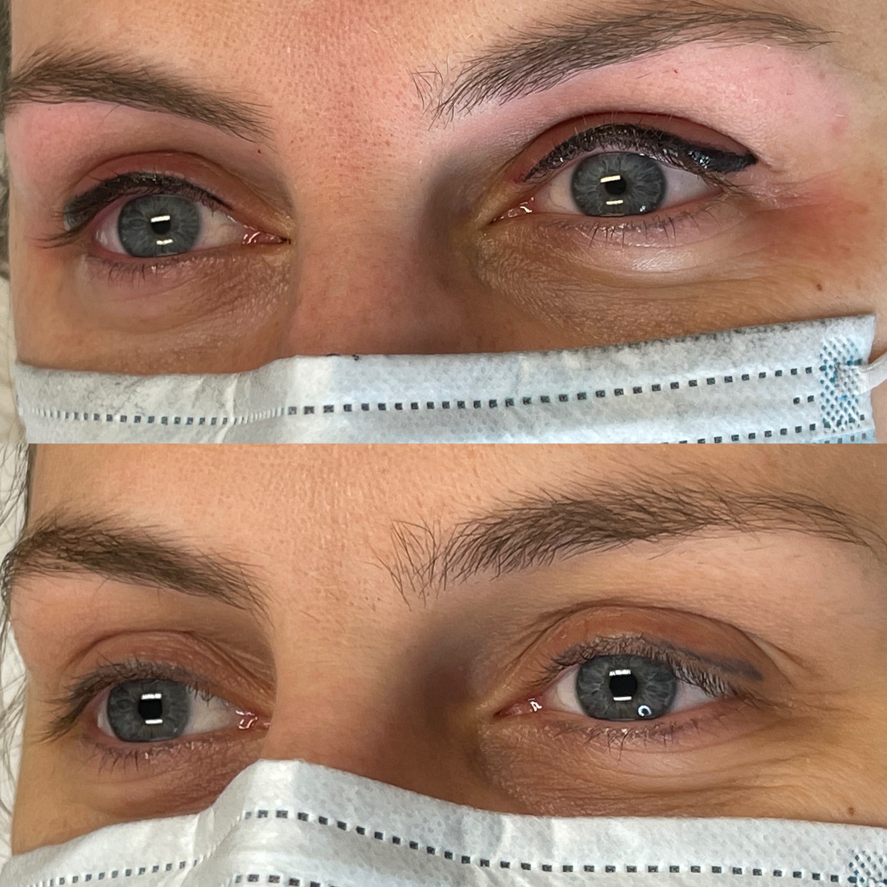 Images Clinique d'Esthétique Leila - Hydrafacial, Microblading, Épilation Laser Sainte-Foy