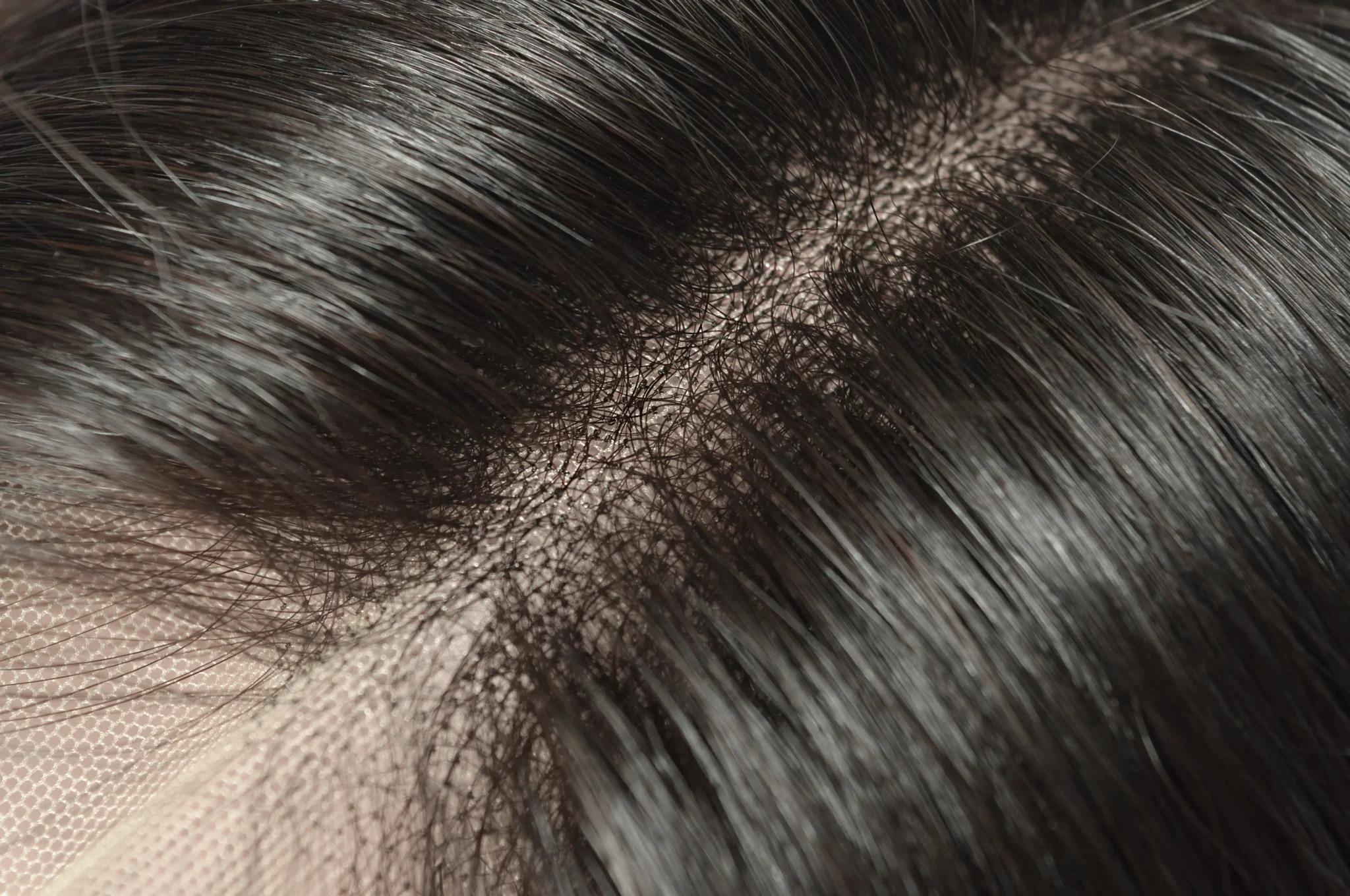 Bilder Hair for you - Perücken - Haarteile - Echthaarperücken München