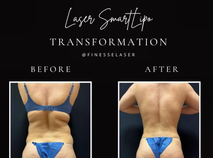 Images Finesse Cosmetic Surgery