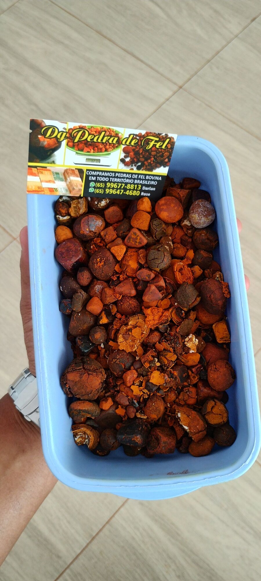 Images Dg pedras de fel bovinos