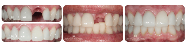 Images Aspire Dental Care PLLC