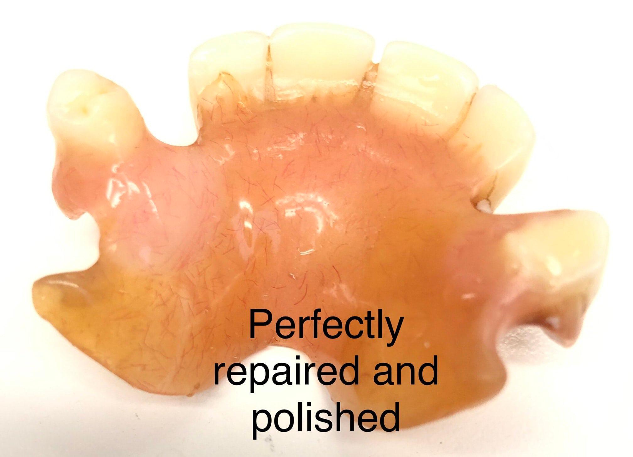 Images Mobile Denture Repair