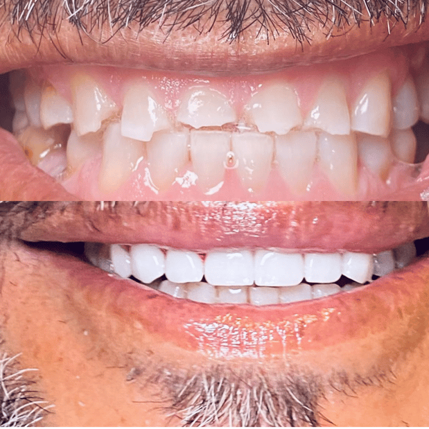 Images Selfie Smiles Dental Group