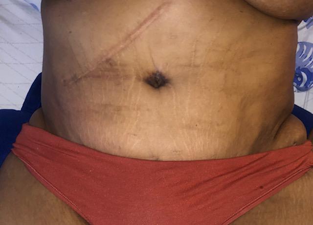 Images TMD Post-op Services