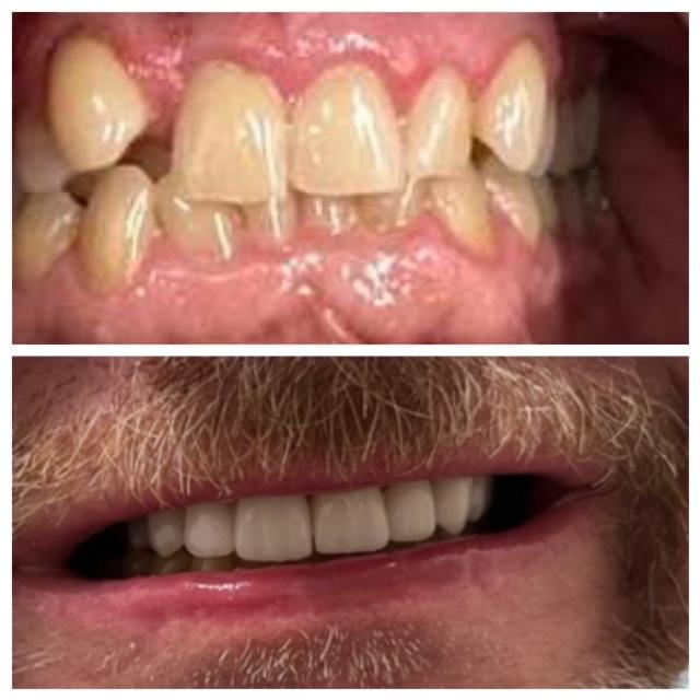 Images Best Dental - Family & Orthodontics