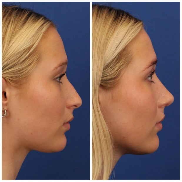 Images Dr. Sumit Bapna, MD