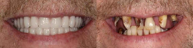 Images Dr. John Fish, DDS