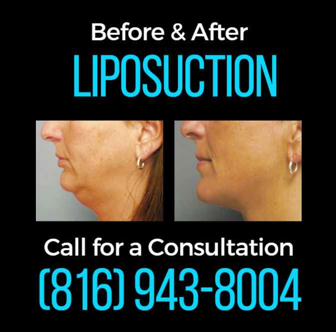 Images Dr. Joseph R. Barnthouse, MD