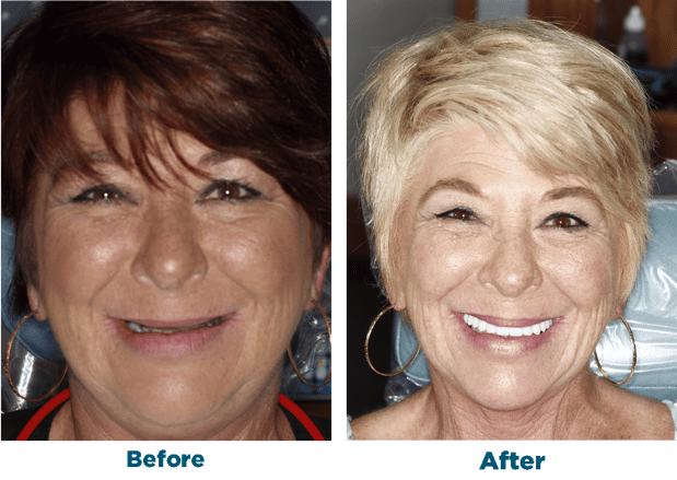Images Smiles for Life Dental Care - Bridgewater