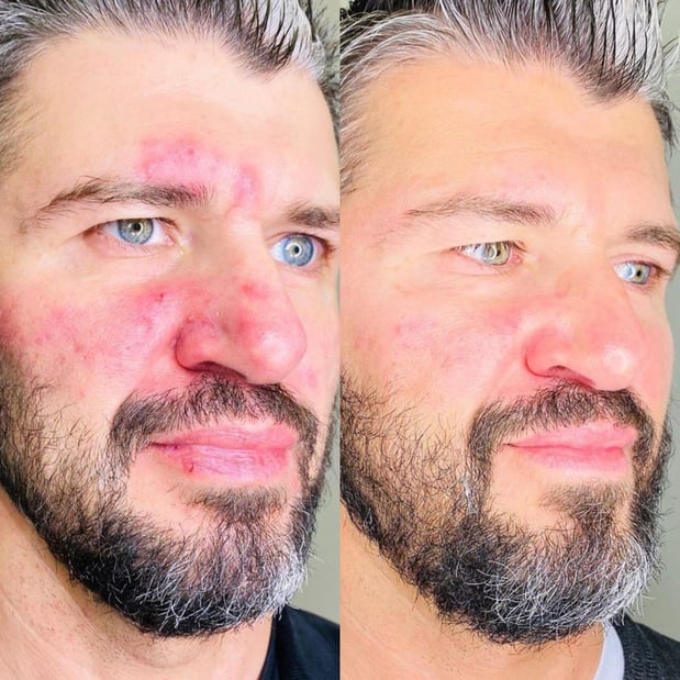 Images Injections and Co.