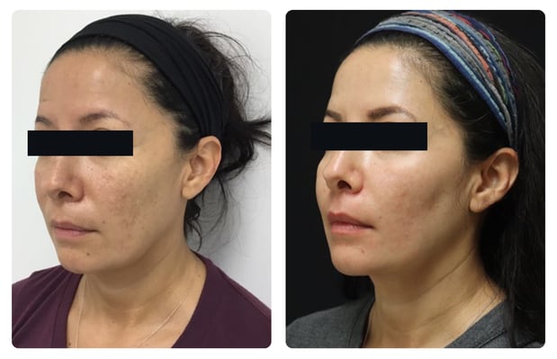 Images Glösense Dermatology & Aesthetic