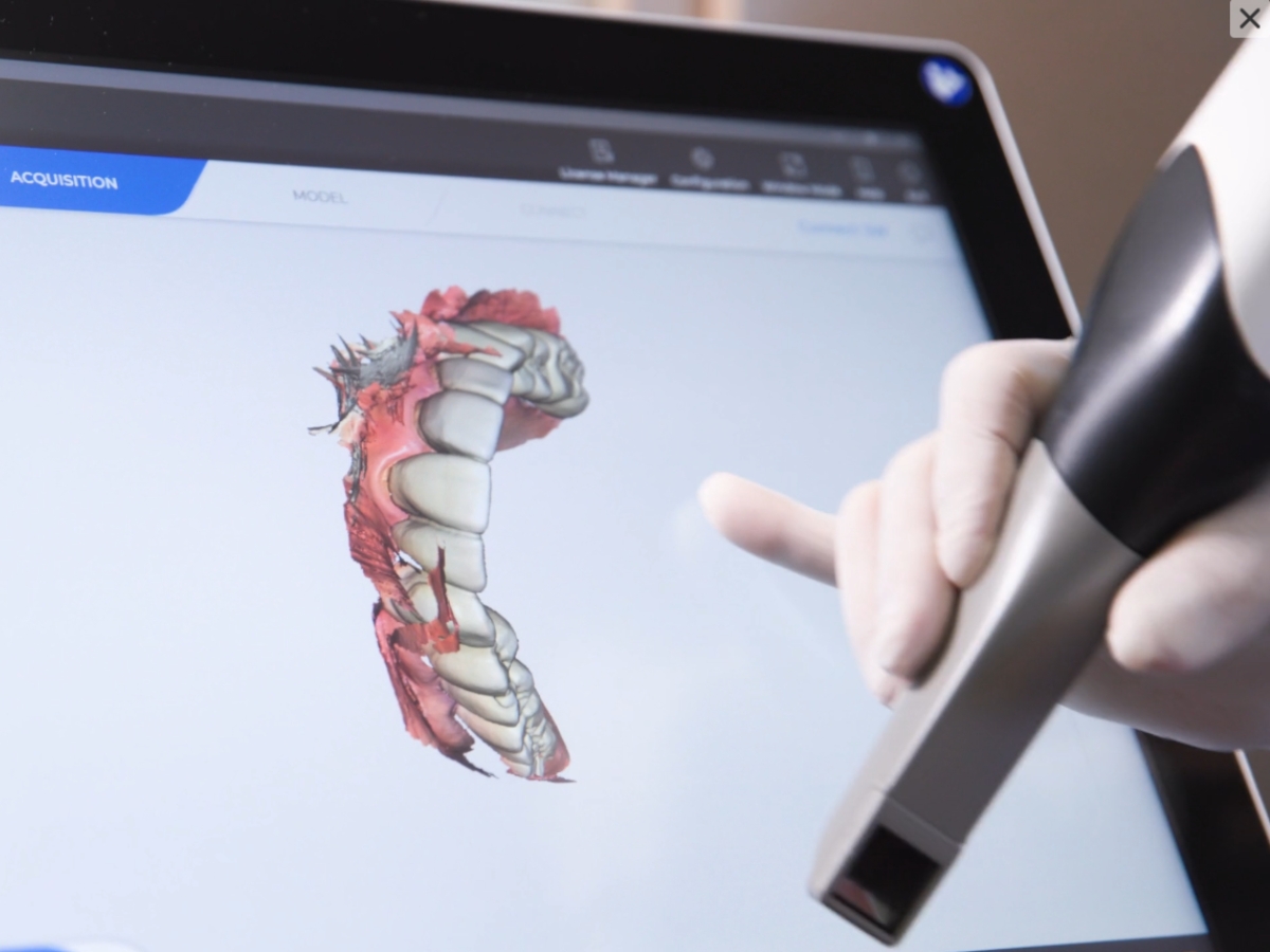 Digital scanner dental imaging for precision diagnosis and treatment planning.

Above and Beyond Den 