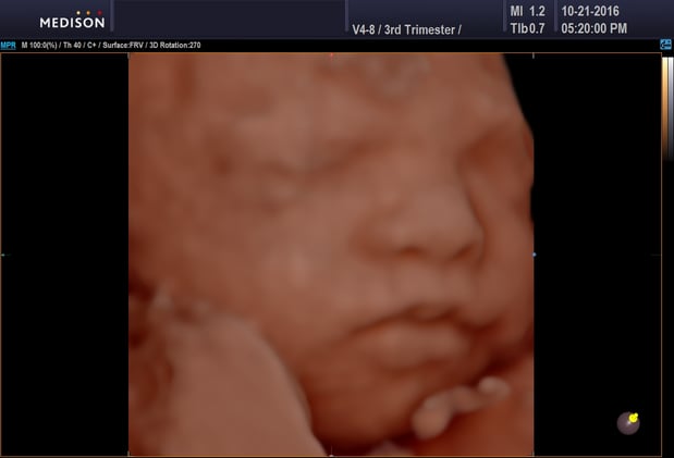 Images Heavenly 3D 4D Ultrasounds