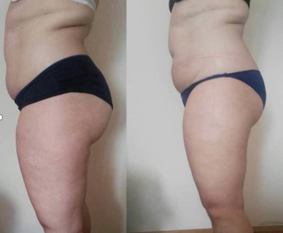 Vacuum Fit 100, Ackerstrasse 16 in Kloten