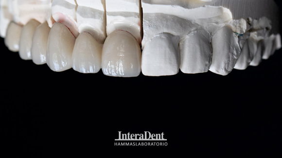Images Hammaslaboratorio InteraDent