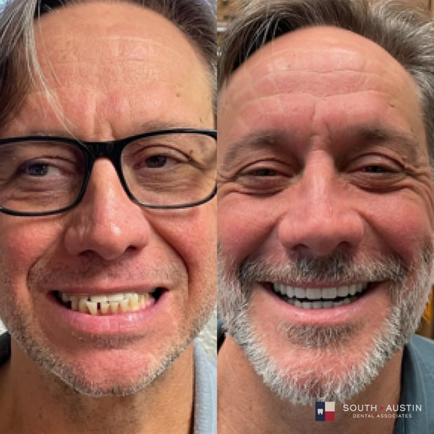 Images South Austin Dental Associates