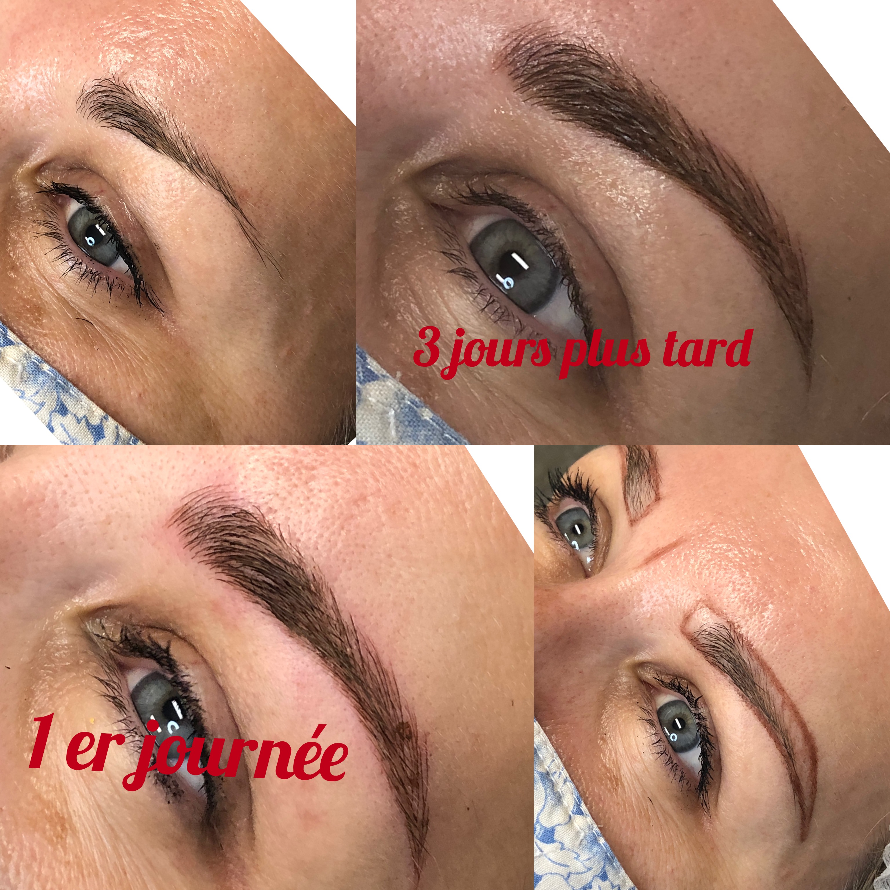 Images Clinique d'Esthétique Leila - Hydrafacial, Microblading, Épilation Laser Sainte-Foy