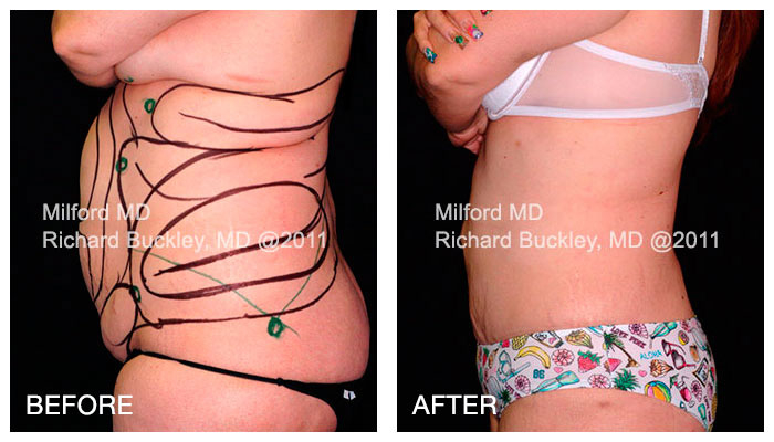 Images MilfordMD Cosmetic Dermatology Surgery & Laser Center