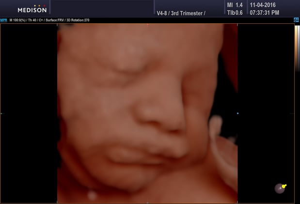 Images Heavenly 3D 4D Ultrasounds