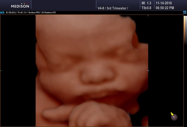 Images Heavenly 3D 4D Ultrasounds