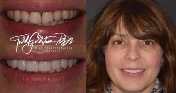 Images Todd Goldstein DDS