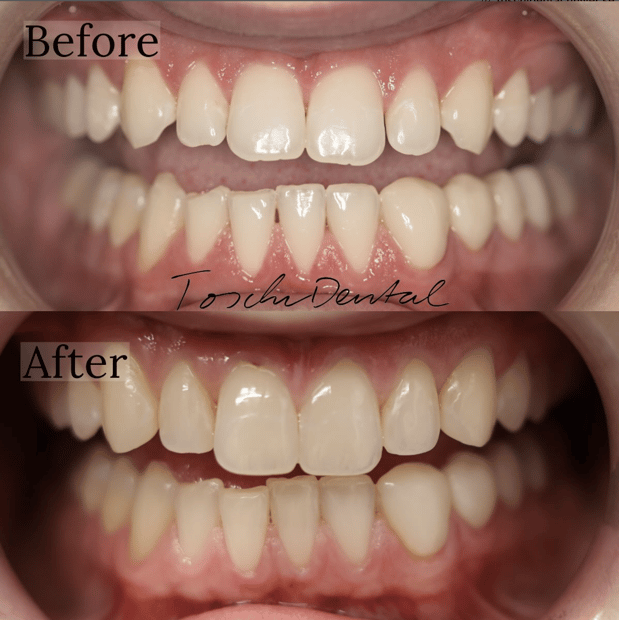 Images Toschi Dental: Steven M. Toschi, DDS and Jeffery Toschi, DMD