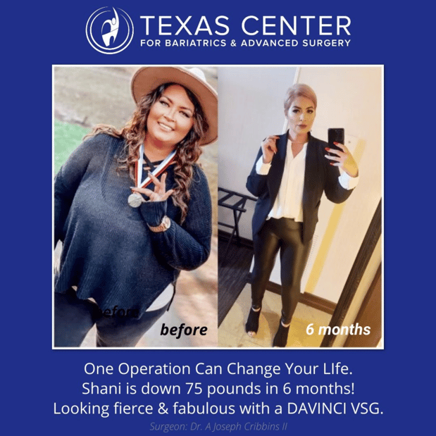 Images Texas Center for Bariatrics & Advanced Surgery