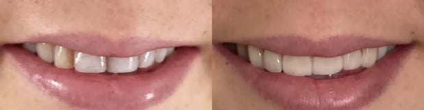 Images River Oak Dental