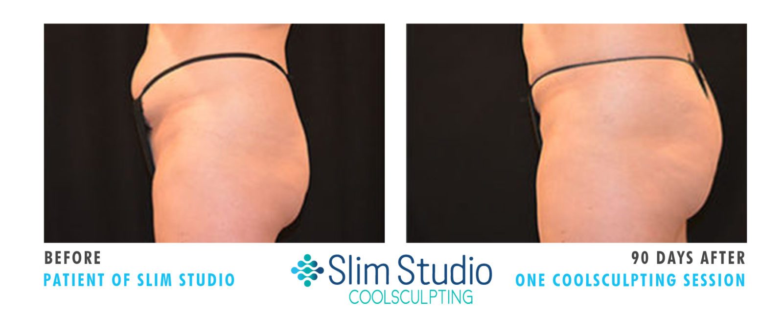 Slim Studio EMSCULPT & Coolsculpting Photo