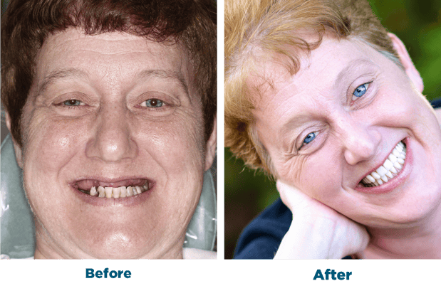 Images Smiles for Life Dental Care - Bridgewater