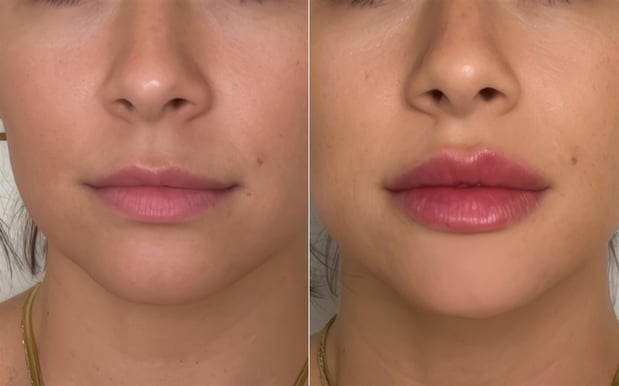 Images RAVE Spa & Clinic