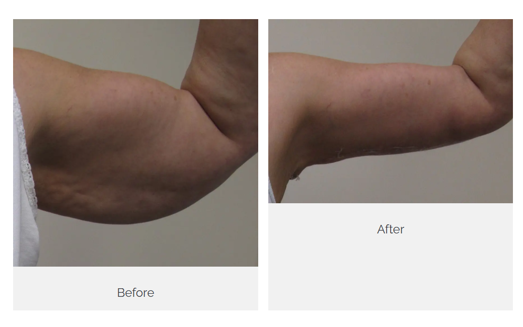 Castellano Cosmetic Surgery Center Image