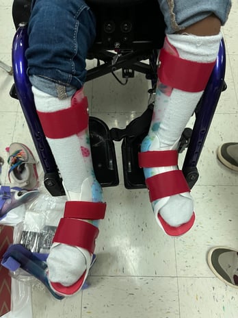 Images EastPoint Prosthetics and Orthotics