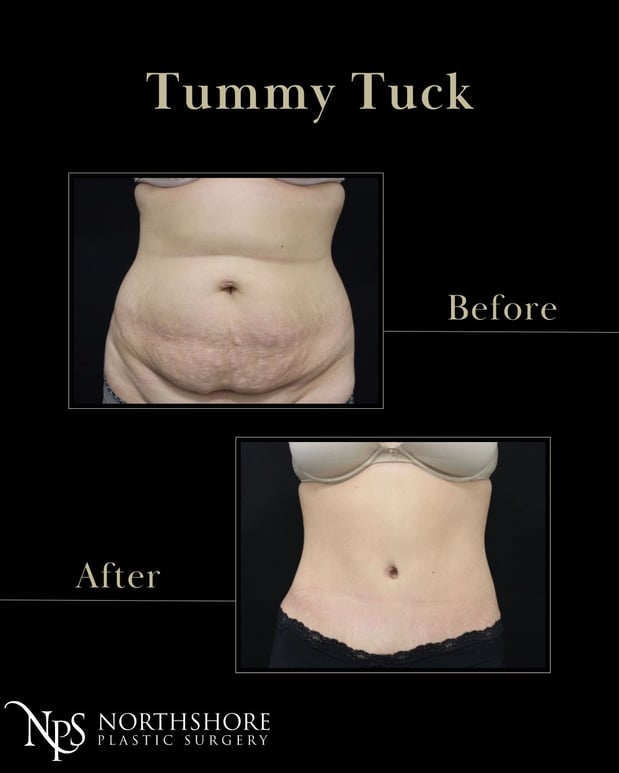 Images Northshore Plastic Surgery LLC