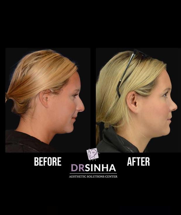 Images Pradeep K Sinha MD PhD FACS - Facial Aesthetic Surgery