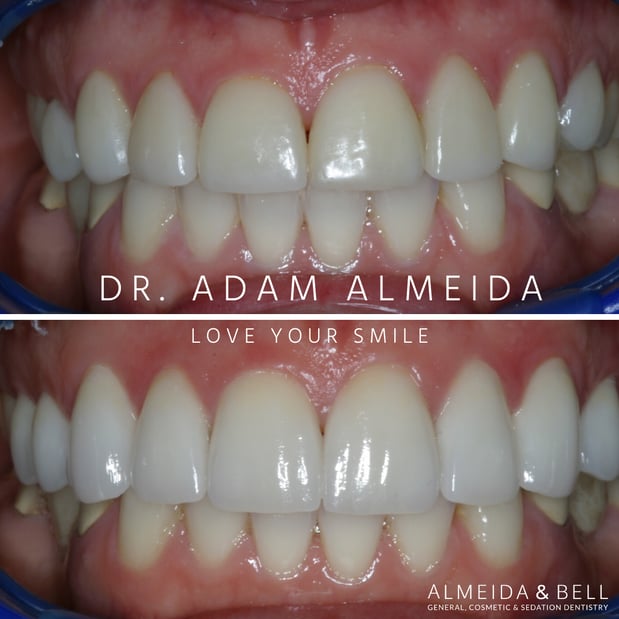Images Almeida & Bell Dental Lone Tree - General, Cosmetic, and Implant Dentistry